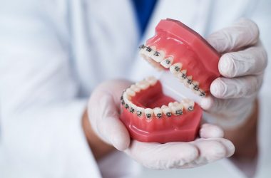 the doctor shows how the system of braces on teeth is arranged